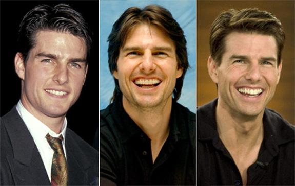 Tom Cruise šim aktierim pieder... Autors: UglyPrince Slevenību Zobi