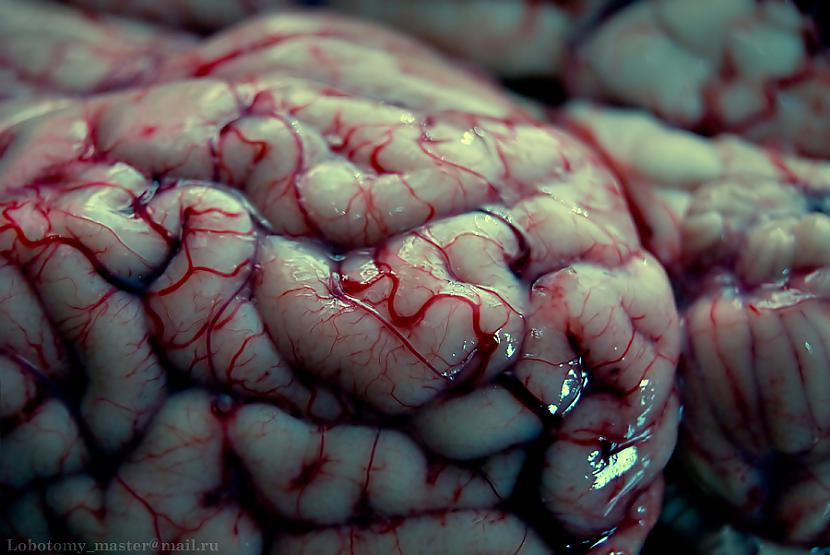 Protēzes smadzenēm Aizvietot... Autors: Wicked Sick Labākie izgudrojumi