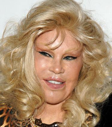  Autors: mazakuce Jocelyn Wildenstein