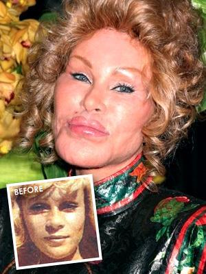  Autors: mazakuce Jocelyn Wildenstein