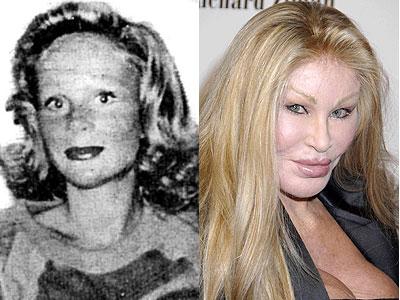  Autors: mazakuce Jocelyn Wildenstein