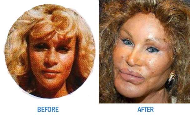  Autors: mazakuce Jocelyn Wildenstein