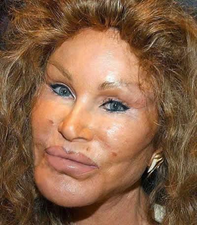 3Jocelyn Wildenstein  Holy... Autors: Fosilija Neglītāko slavenību TOP 20!