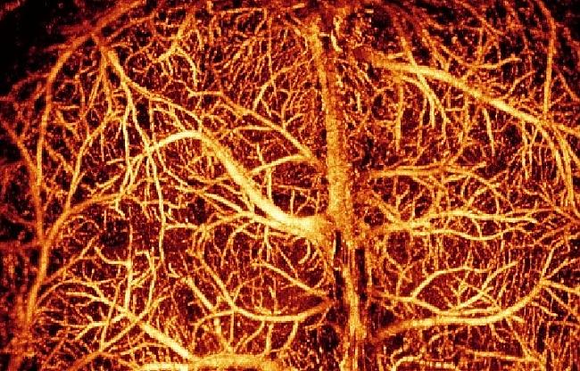 Smadzeņu asinsvadu kopējais... Autors: Moonwalker Fakti par smadzenēm