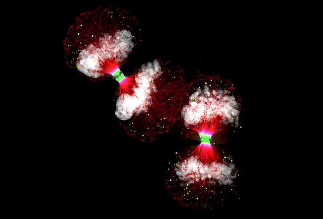 Divas cilvēka vēža šūnas pirms... Autors: AndOne Mikrofotogrāfija