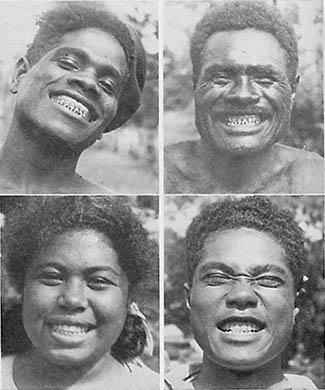 Melanēziešiem ir nelielas... Autors: Sabana Australoīdu rase