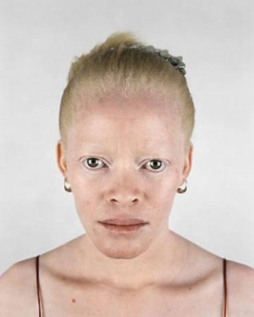  Autors: marju6ka Āfrikas albīni