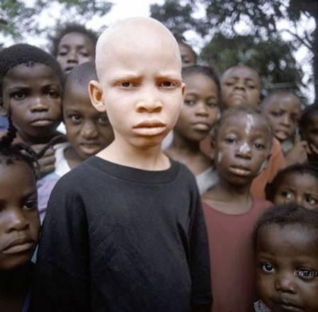 Kopš senajiem laikiem tur ir... Autors: marju6ka Āfrikas albīni