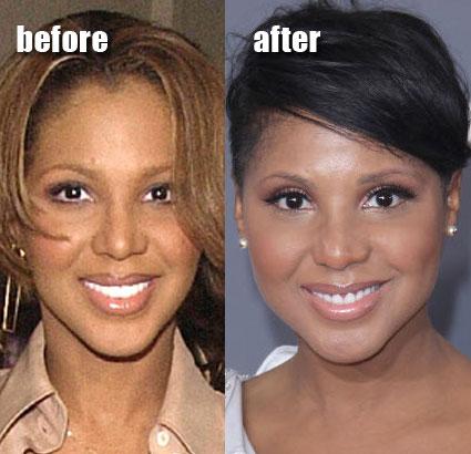 Toni Braxton Autors: moodway Pirms Un Pēc