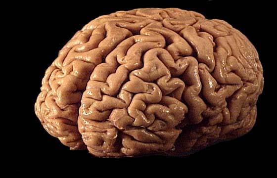 Diennaktī cilvēka smadzenes... Autors: arenas000 Neticami, bet fakts. 5