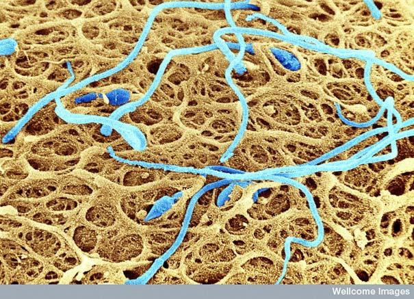 Spermatozīdi uz cilvēka... Autors: MILFS Aplūkojot pasauli ar mikroskopu