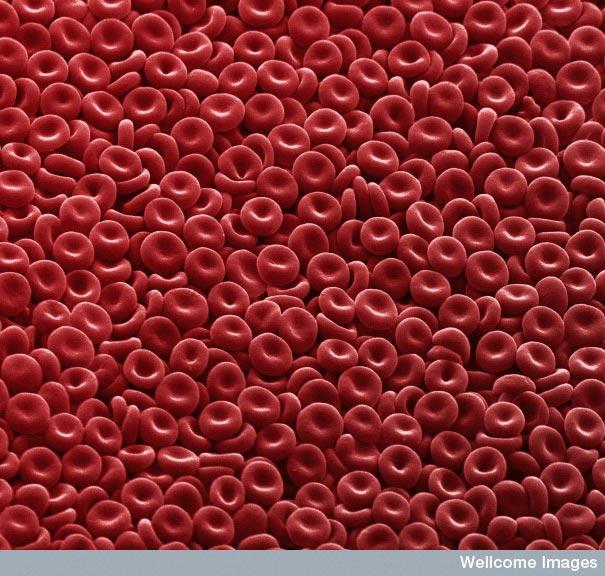 Eritrocīti jeb sarkanie asins... Autors: MILFS "2" Aplūkojot pasauli ar mikroskopu