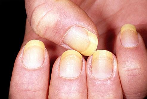 Nagi atspoguļo tavu veselības... Autors: Duality Facts about nails