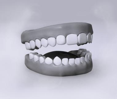 Cilvēkam zobi sāk augt jau... Autors: varenskrauklis Neparasti fakti par cilvēka ķermeni.