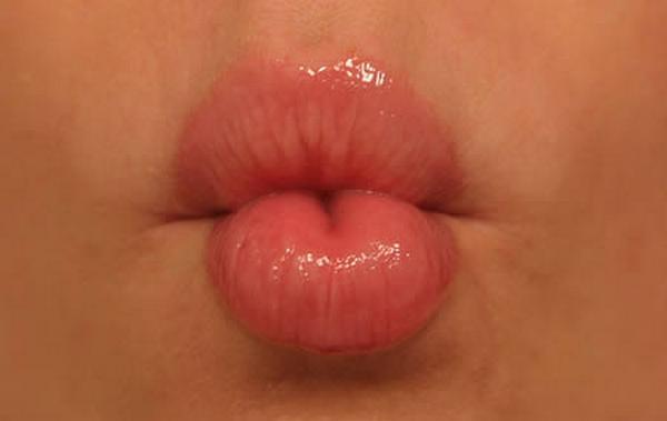 Alerģija pret bučošanos Nu nav... Autors: P a G a L e Dīvainās alerģijas