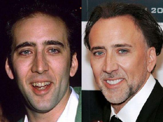 Nicolas Cage Autors: MJ Slavenību zobi pirms un pēc!