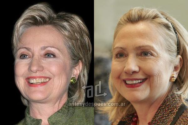 Hillary Clinton Autors: iikssa Holivudas smaids