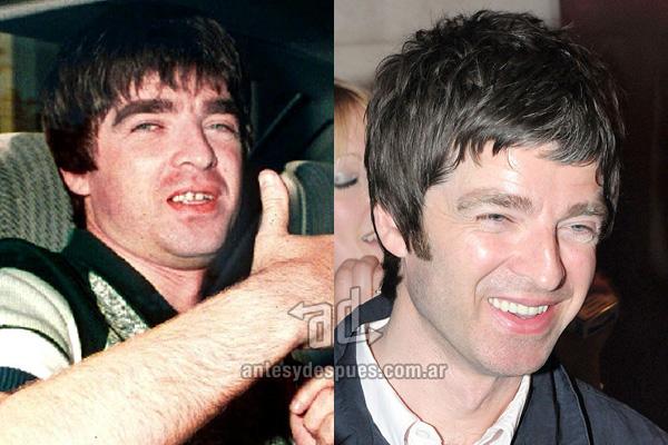 Noel Gallagher Autors: iikssa Holivudas smaids