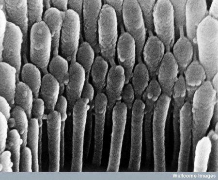 Matiņikas aug mums ausīs Autors: Karapietka Cilvēks zem mikroskopa.