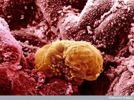 6 dienu jauns embrijs Autors: Karapietka Cilvēks zem mikroskopa.