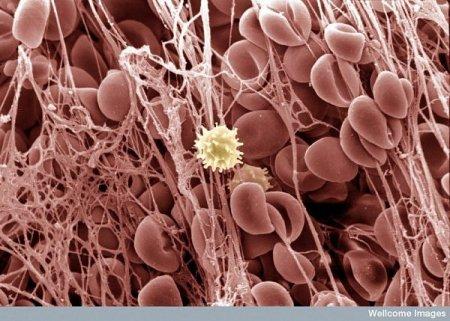 sarecētas asinis Autors: Karapietka Cilvēks zem mikroskopa.