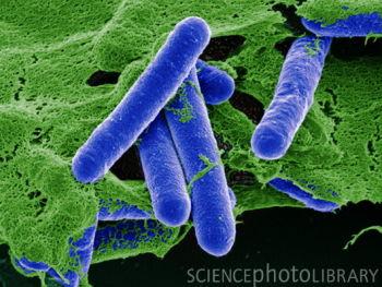 1g indesko izdala  Clostridium... Autors: zelta zivtele Baktērijas