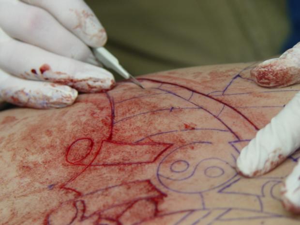  Autors: kjekata scarification