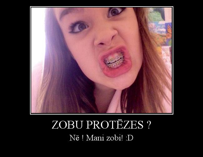 Zobu protēzes ?