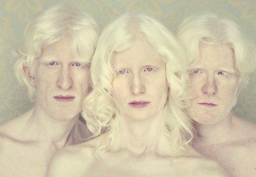  Autors: kjuvertijs Ar albīnismu sirgstošu cilvēku portreti
