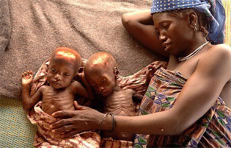 Nigērijā visiem dvīņiem gan... Autors: Ben4iks Aizraujoši Fakti [1]