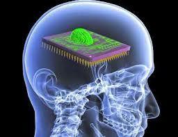 Smadzenes veido ap 2 ķermeņa... Autors: Akumulators Some shit about brain.