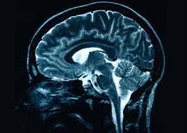 Smadzenēs signāls pārvietojas... Autors: Akumulators Some shit about brain.