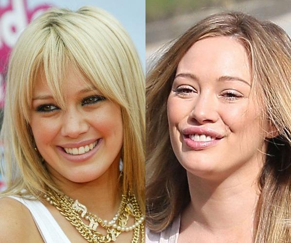 Hilary Duff Autors: spongebobRIP 10 slavenību izskati pirms un pēc plastiskās operācijas