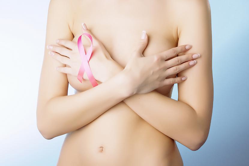 Krūts vēzisKas izraisa lielāko... Autors: ICY_HELL 10 stāvokļi, kas pārmantojas ģenētiski
