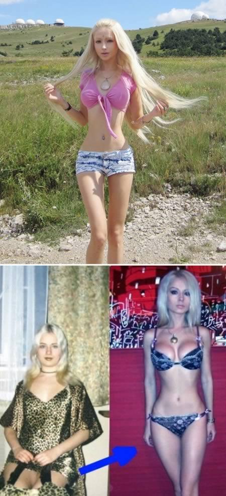 Krievu bārbija kas gribēja... Autors: Fosilija Pārspīlētā plastiskā ķirurģija..