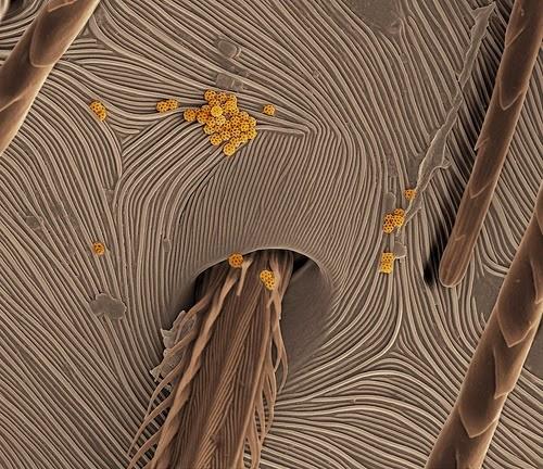 Zirnekļa āda Autors: Sprinteris Zem Mikroskopa