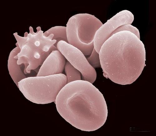 Sarkanie asins ķermenīscaroni Autors: Sprinteris Zem Mikroskopa