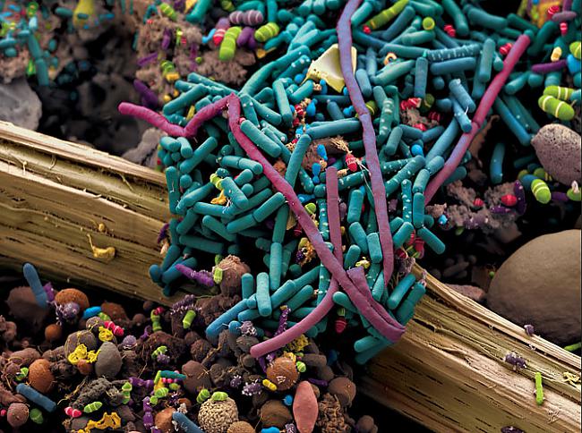 Zarnu baktērijasnbspBildē kas... Autors: Lestets Cilvēka ķermeņa Zoo
