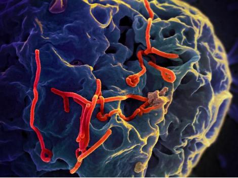 Simptomi 221 dienai kopscaron... Autors: LauraBlack Ebolas vīruss