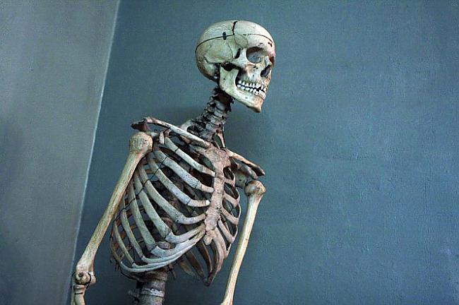 Cilvēka skeletsDivas... Autors: Fosilija 10 dīvainākie atradumi lidmašīnas pasažieru somā