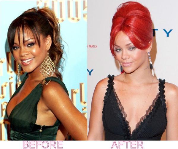 Dziedātāja  Rihanna Rianna Autors: Vafeleens Before and After (slavenības) 2