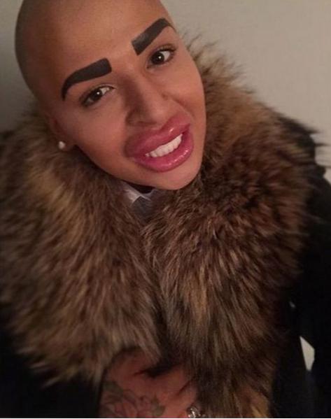 Instagrama viņam ir 22000... Autors: hagisons112 Čalis iztērē 150 tūkstoš dolārus lai izskatītos kā Kim Kardashian