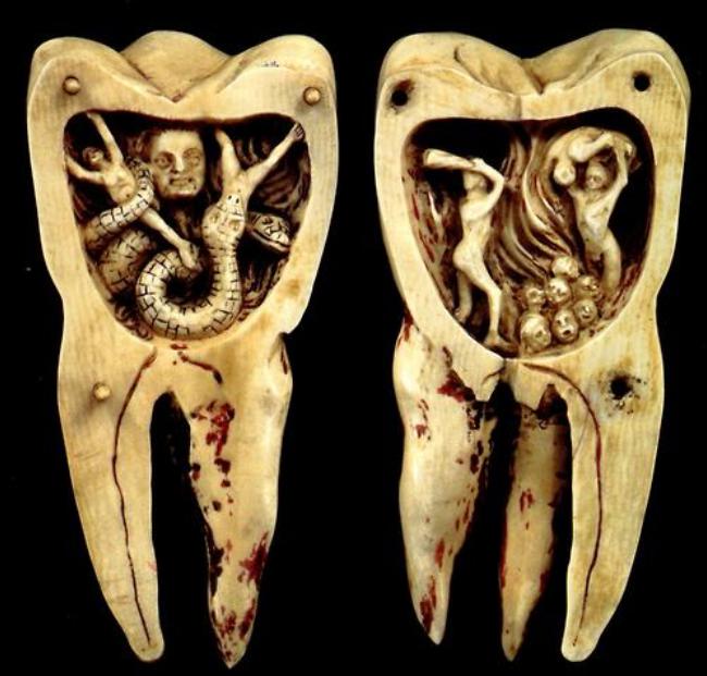 Sapratnes nomaiņa par zobu... Autors: Lestets Cīņa ar zobu tārpu