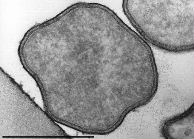 Hipertermofili ir baktēriju... Autors: Prāta Darbnīca Dzīvība, kas eksistē visekstremālākajos apstākļos