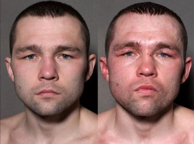  Autors: olološD Bokseru sejas pirms un pēc kautiņiem.