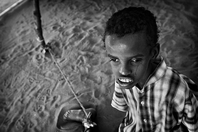13 gadus vecais Ahmeds Adans... Autors: droop Psihiski slimie Āfrikā