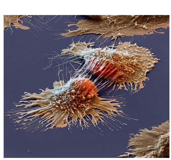 Vēža scaronūnas mikroskopā Autors: kaķūns 60+ interesanti foto ar aprakstiņiem #3