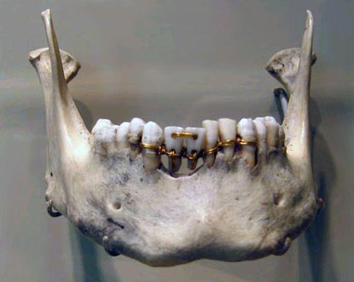 Senās Ēģiptes zobārstniecība Autors: kaķūns 70 interesanti foto ar aprakstiņiem #6