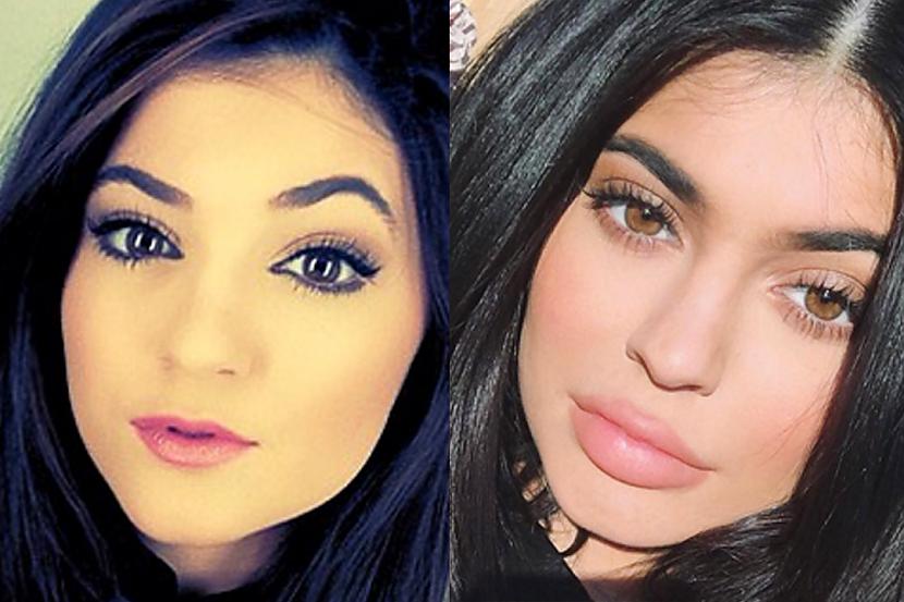 2 Lielas lūpasViņas lielākais... Autors: Kylie Jenner 10 Kailijas Dženeres skaistuma noslēpumi