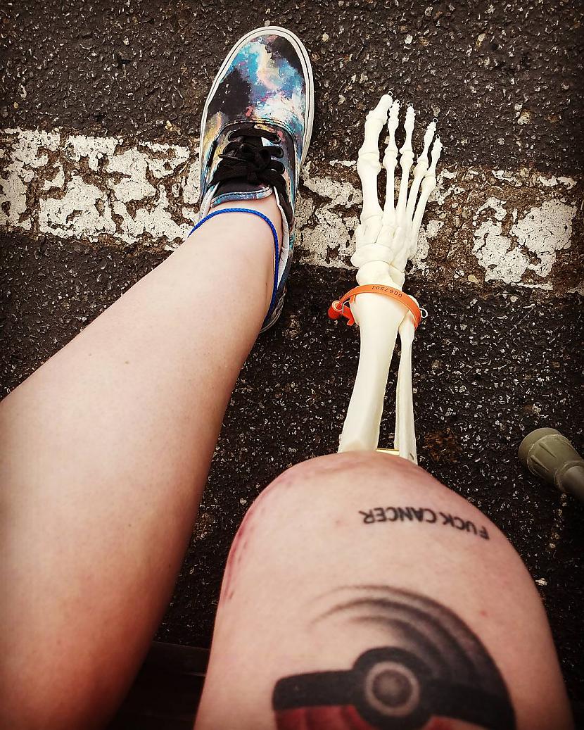  Autors: matilde Amerikānietes Instagram profils vēsta par piedzīvojumiem ar amputētu kāju